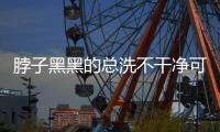 脖子黑黑的总洗不干净可能是病了�，这些疾病信号赶紧自查