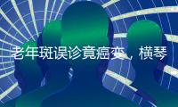 老年斑误诊竟癌变，横琴医院提醒
：医学美容需科学诊断与规范治疗